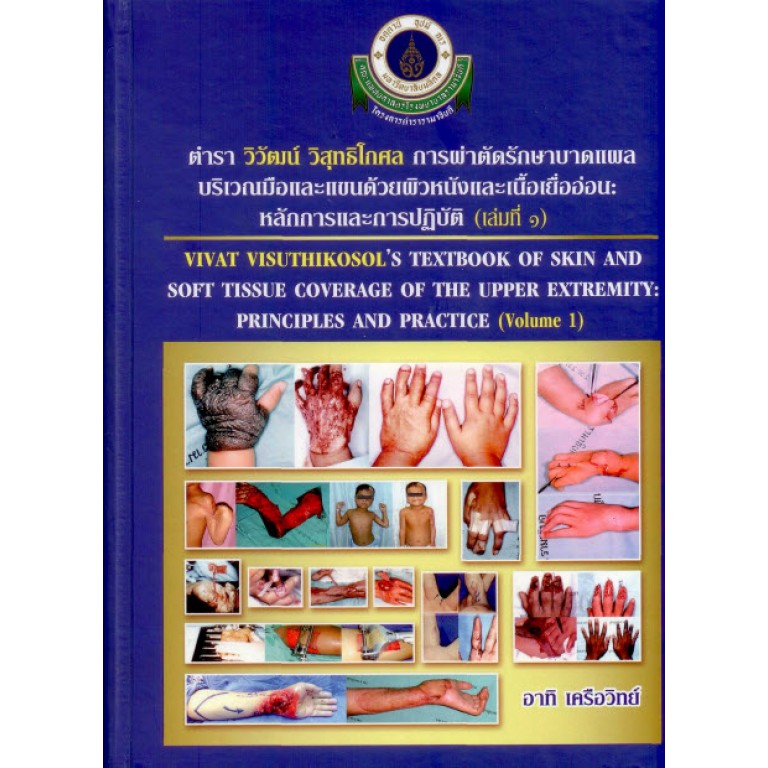 ตำรา วิวัฒน์ วิสุทธิโกศล : การผ่าตัดรักษาบาดแผลบริเวณมือและแขนด้วยผิวหนังและเนื้อเยื่ออ่อน : หลักการและการปฏิบัติ