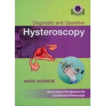 Diagnostic and Operative Hysteroscopy